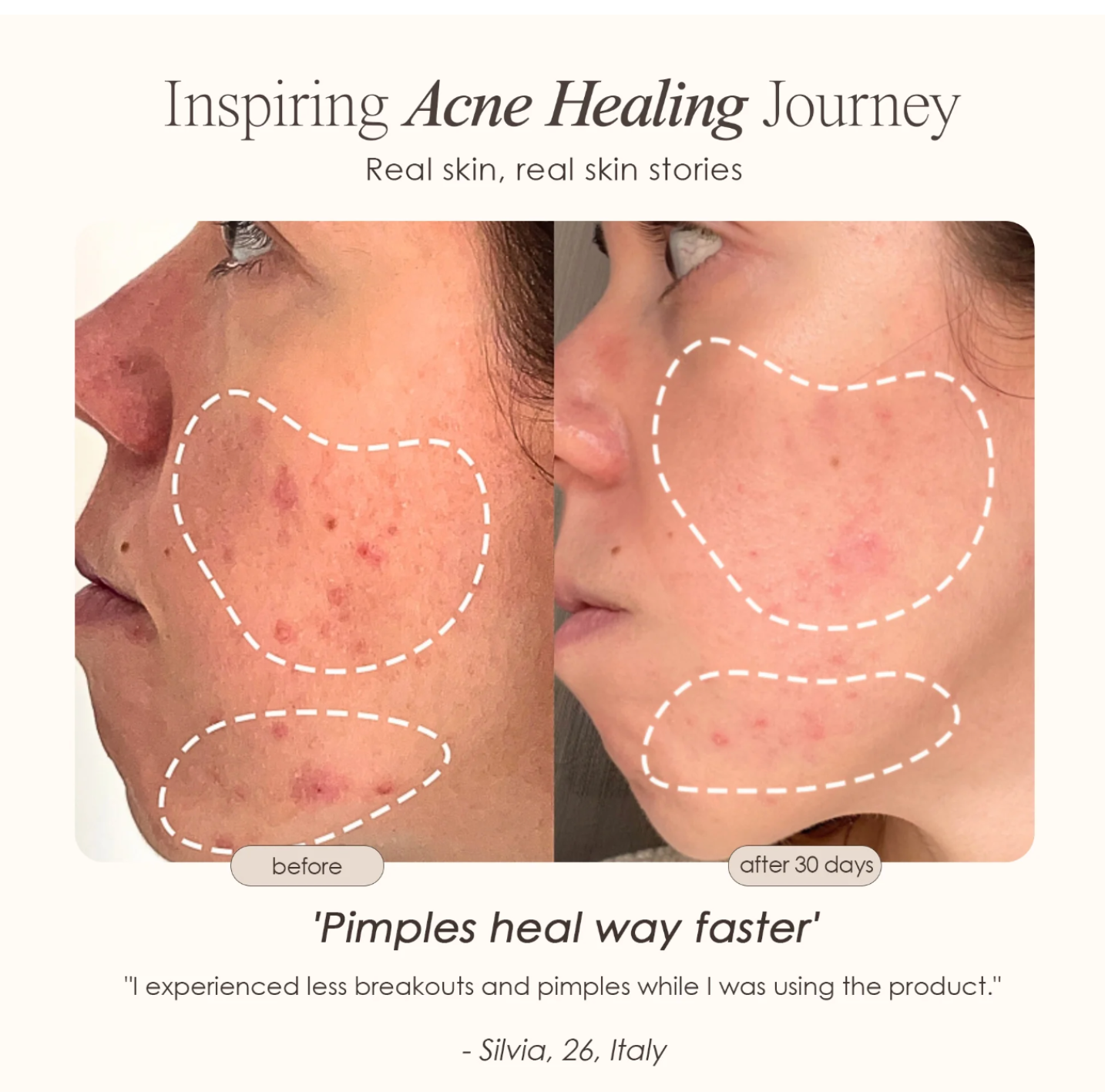 The Glow Mask™ by Nova Skin LED Facial Neck Skin Rejuvenation Mask